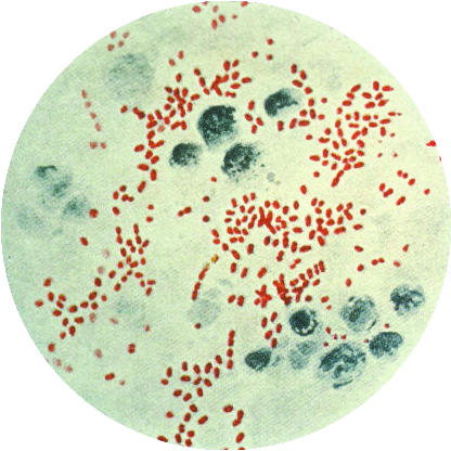 Bubonic plague under a microscope