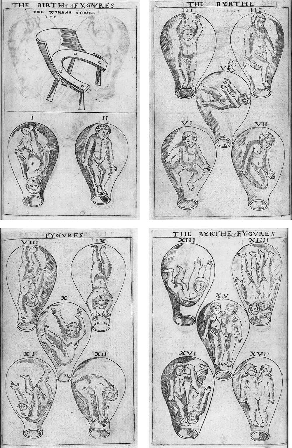 The Byrthe Fygures, from Eucharius Rösslin’s The Byrth of Mankynde, 1545. Wellcome Collection.