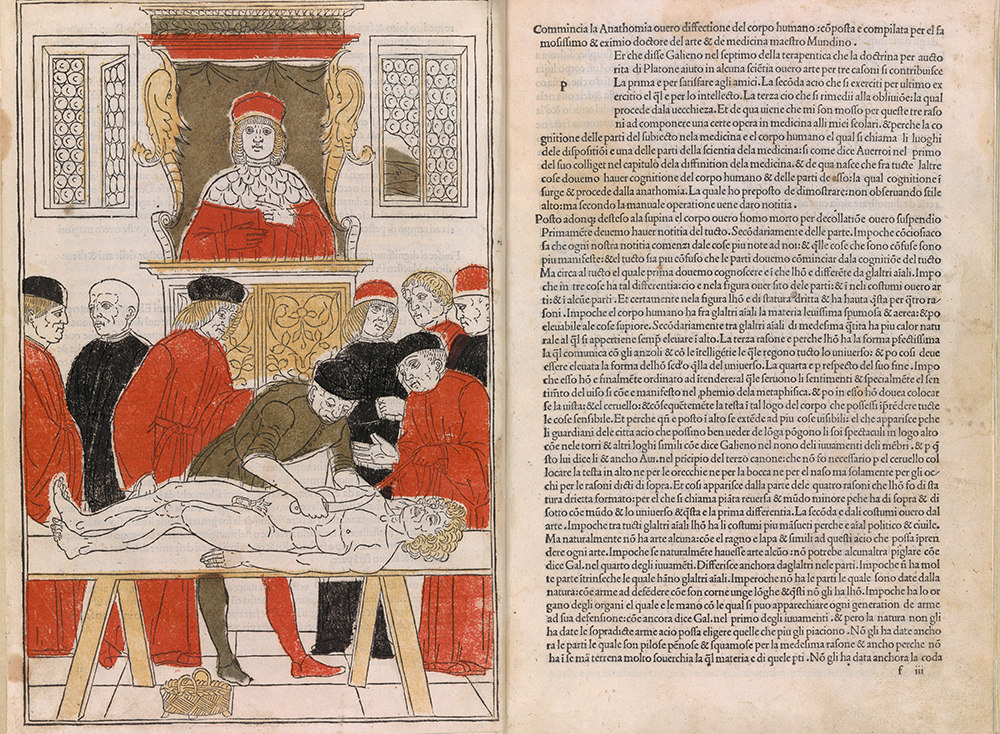 Fasciculo di medicina, possibly by Johannes de Ketham, 1494.