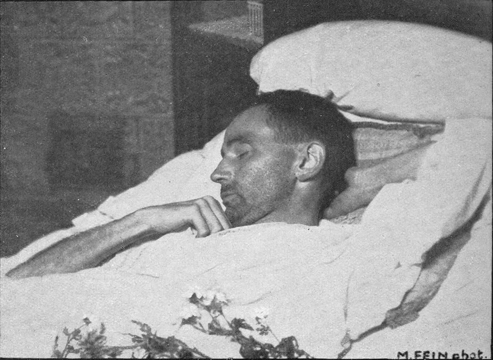 Egon Schiele on His Deathbed, 1918. Photograph by Martha Fein.