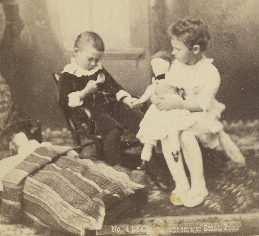 She Has Symptoms of Smallpox, United States, c. 1870 She Has Symptoms of Smallpox, United States, c. 1870