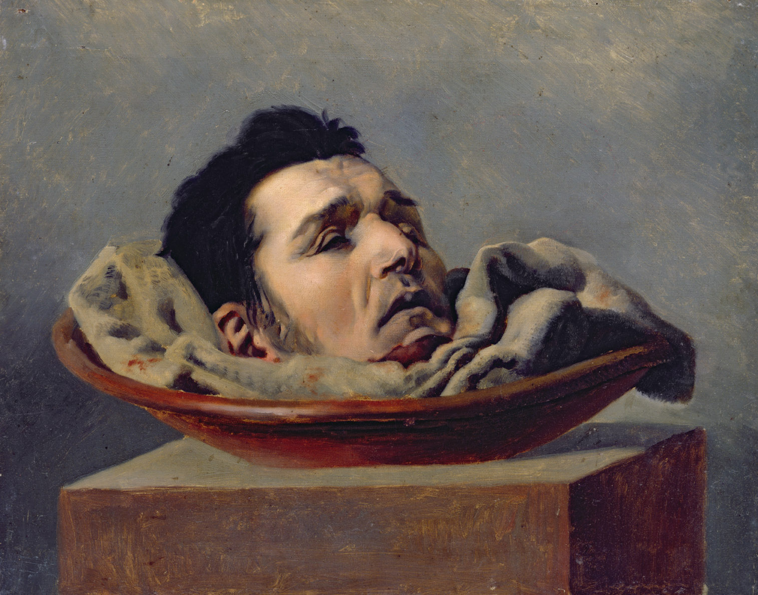 Guillotined Head of a Parricide Executed at Puy in 1825, by François Gabriel de Becdelièvre, c. 1825.