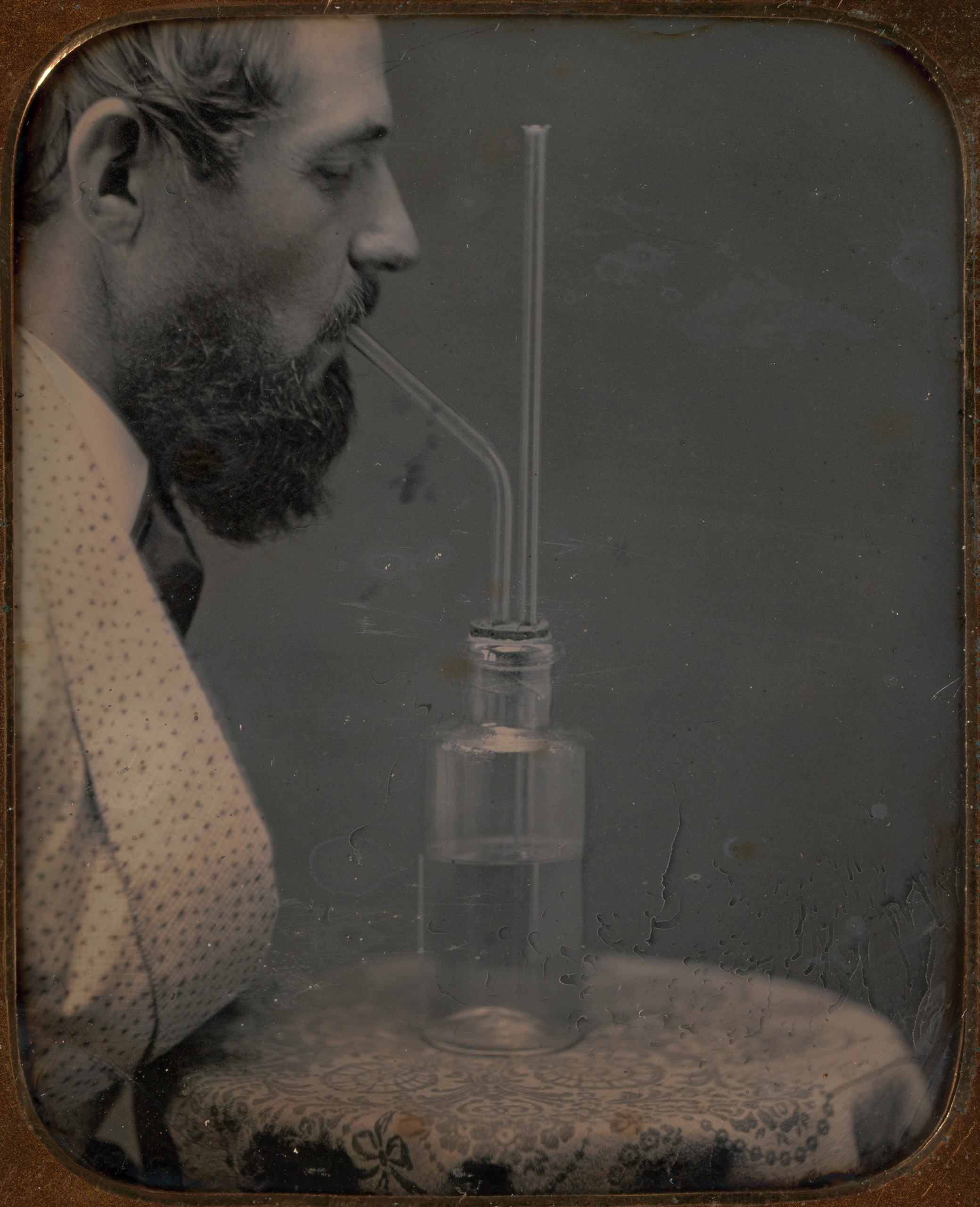 James Hyatt Inhaling Chlorine Gas, by Peter Welling, c. 1850. The Metropolitan Museum of Art, Gilman Collection, Museum Purchase, 2005.