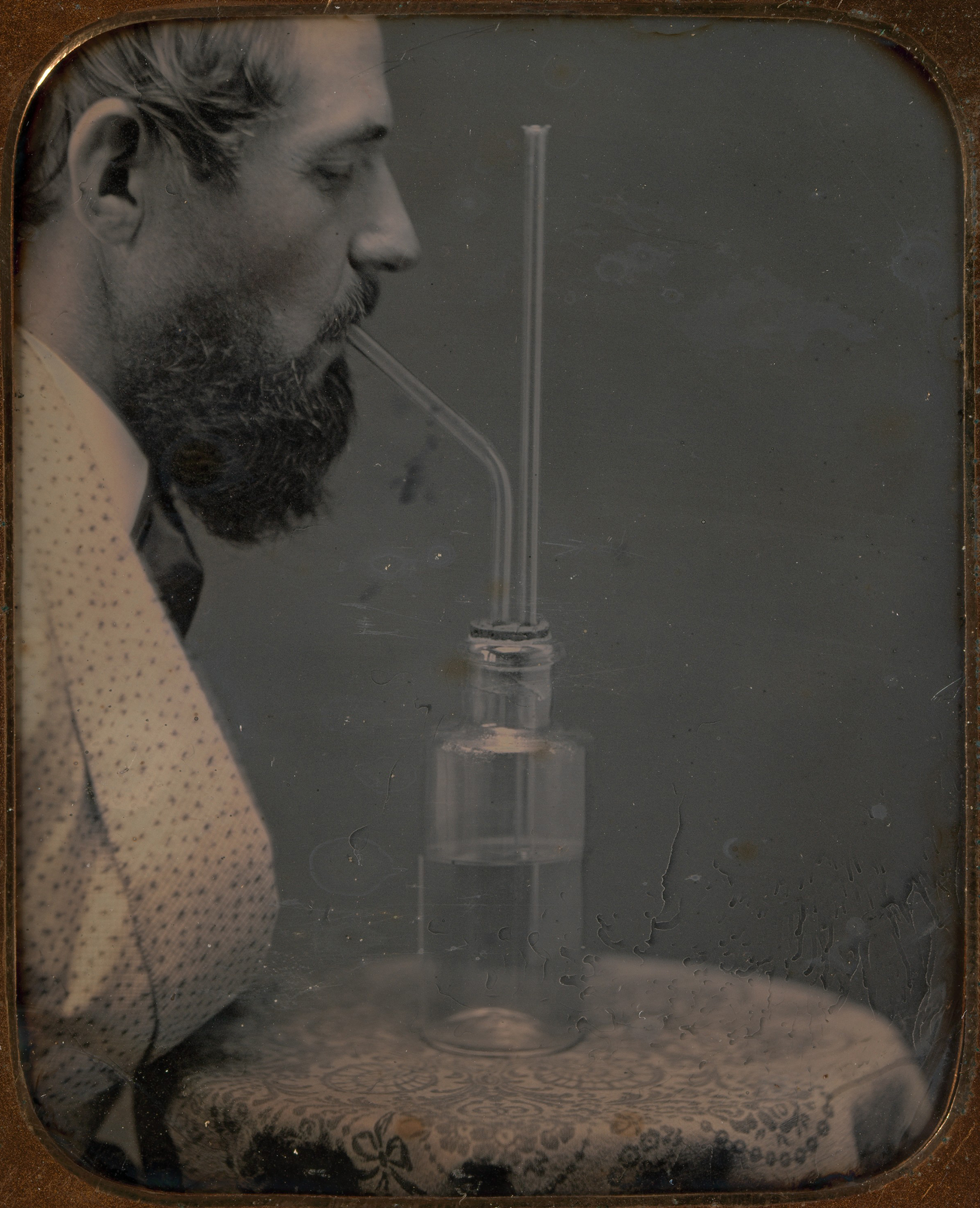 James Hyatt Inhaling Chlorine Gas, by Peter Welling, c. 1850. The Metropolitan Museum of Art, Gilman Collection, Museum Purchase, 2005. James Hyatt Inhaling Chlorine Gas, by Peter Welling, c. 1850. The Metropolitan Museum of Art, Gilman Collection, Museum Purchase, 2005.
