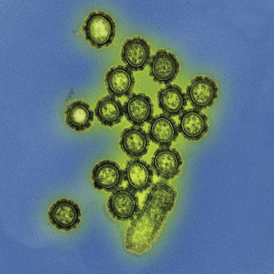 The influenza virus under a microscope