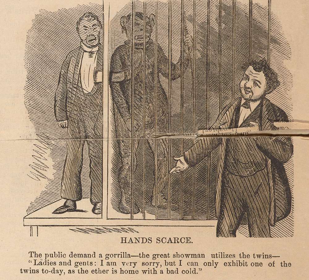 “Incidents in the Lives of the Siamese Twins” (detail), c. 1870. The New York Public Library, The Miriam and Ira D. Wallach Division of Art, Prints and Photographs.