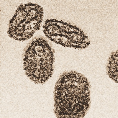 Smallpox under a microscope